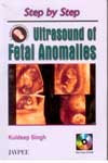 Ultrasound Of Fetal Anomalies