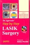 Lasik Surgery