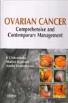 Ovarian Cancer Comprehensive and Contemporary Management