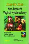 Step by Step Non-Descent Vaginal Hysterectomy