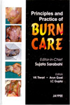 Principles and Practice of Burn Care