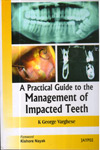 A Practical Guide to the Management of Impacted Teeth