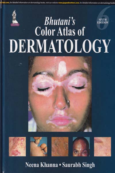 Bhutanis Color Atlas of Dermatology
