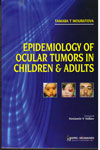 Epidemiology of Ocular Tumors in Children and Adults