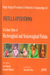 Single Surgical Procedure in Obsterics and Gynaecology 34 Fistula Operations A Colour Atlas of Rectovaginal and Vesicovaginal Fistula