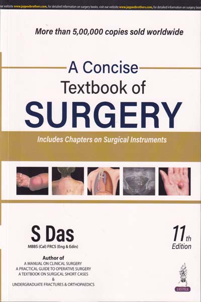 A Concise Textbook of Surgery