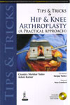 Tips and Tricks in Hip and Knee Arthroplasty