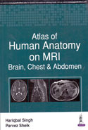 Atlas of Human Anatomy on MRI Brain Chest and Abdomen