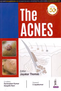 The ACNES