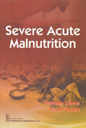 Severe Acute Malnutrition