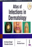 Atlas of Infections in Dermatology