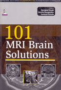 101 MRI Brain Solutions