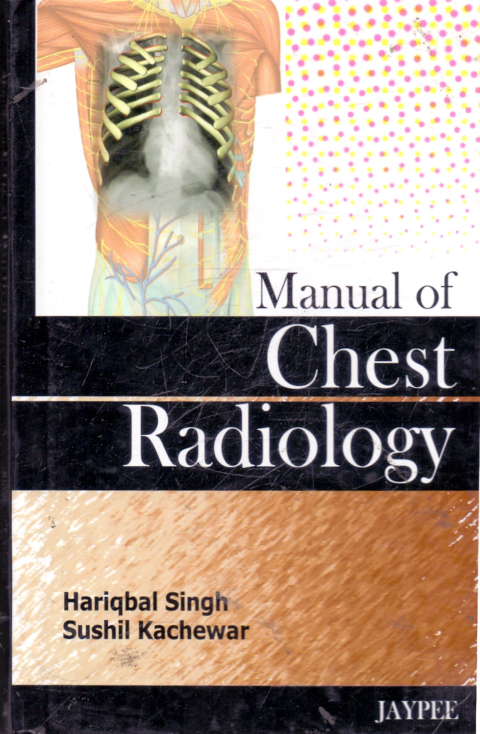 Manual of Chest Radiology